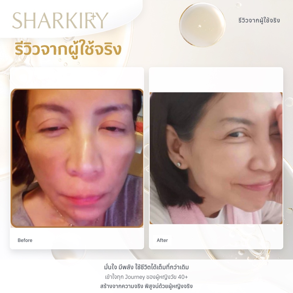 ภาพรีวิวบางส่วนจากผู้ใช้จริงชาร์กิรี่ ภาพที่ 02