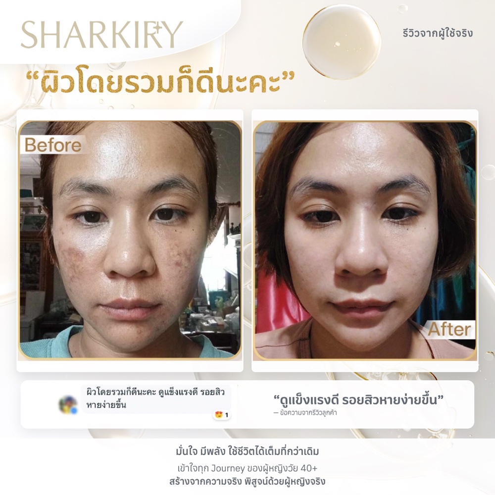 ภาพรีวิวบางส่วนจากผู้ใช้จริงชาร์กิรี่ ภาพที่ 03