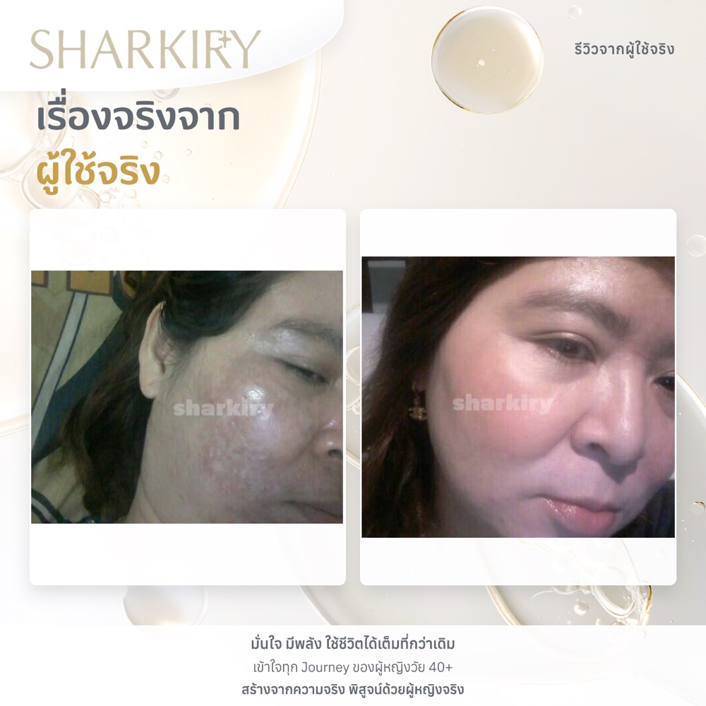 ภาพรีวิวบางส่วนจากผู้ใช้จริงชาร์กิรี่ ภาพที่ 04