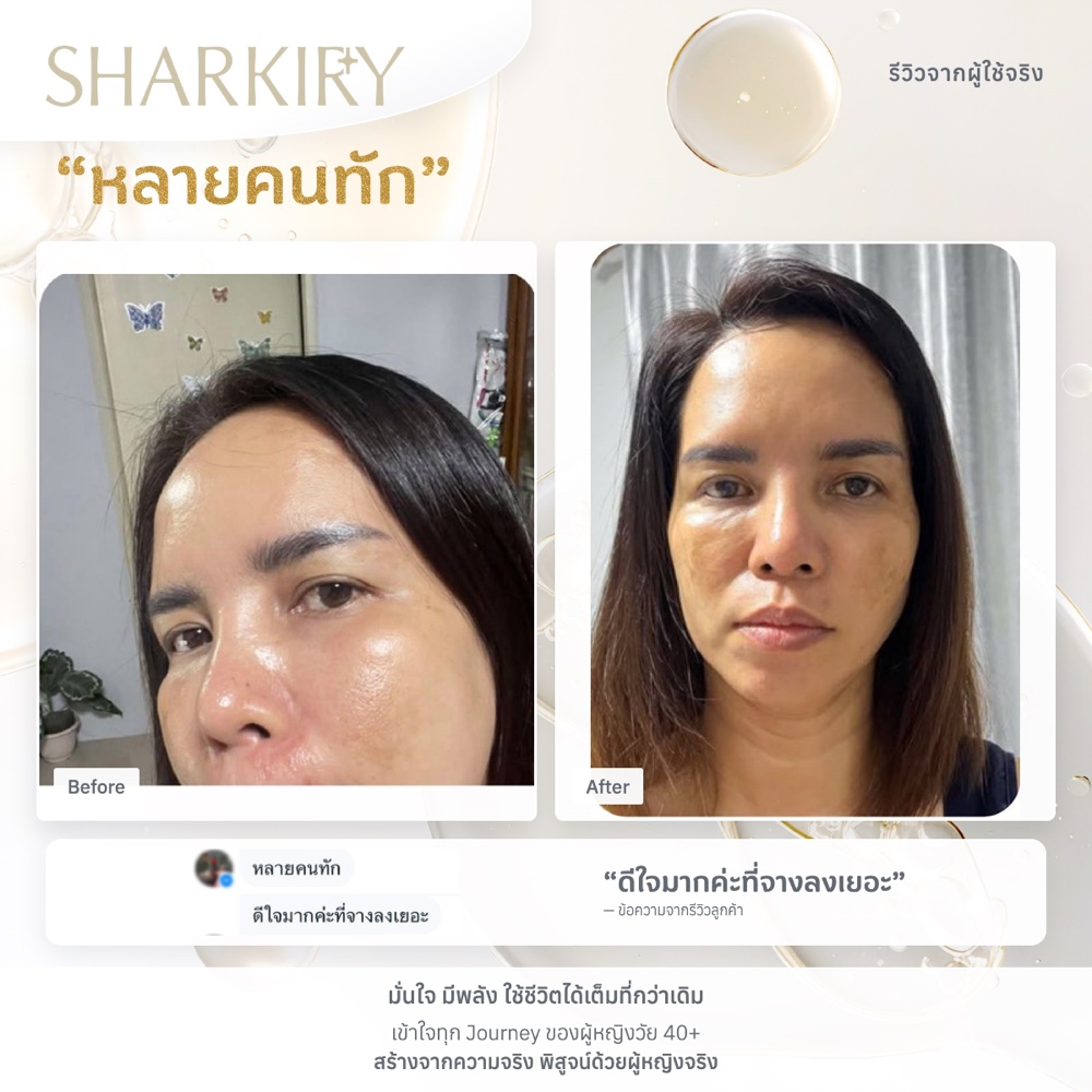 ภาพรีวิวบางส่วนจากผู้ใช้จริงชาร์กิรี่ ภาพที่ 05