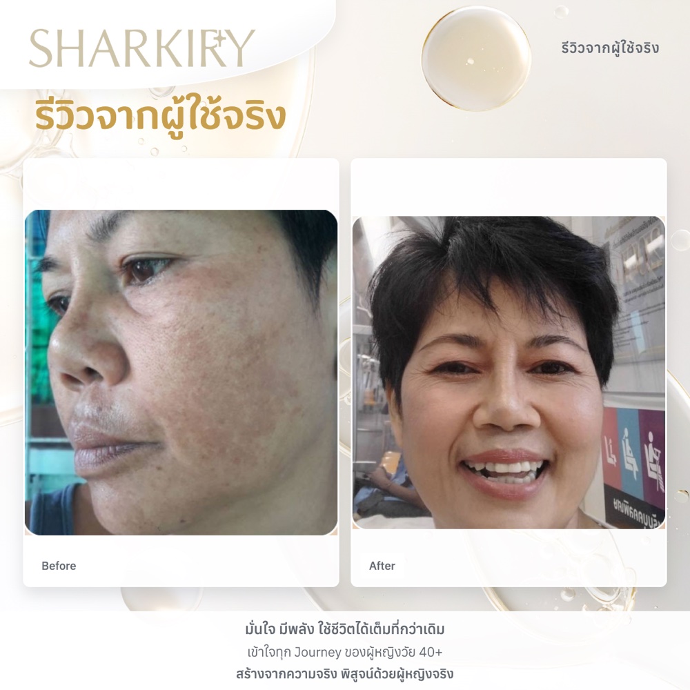 ภาพรีวิวบางส่วนจากผู้ใช้จริงชาร์กิรี่ ภาพที่ 06
