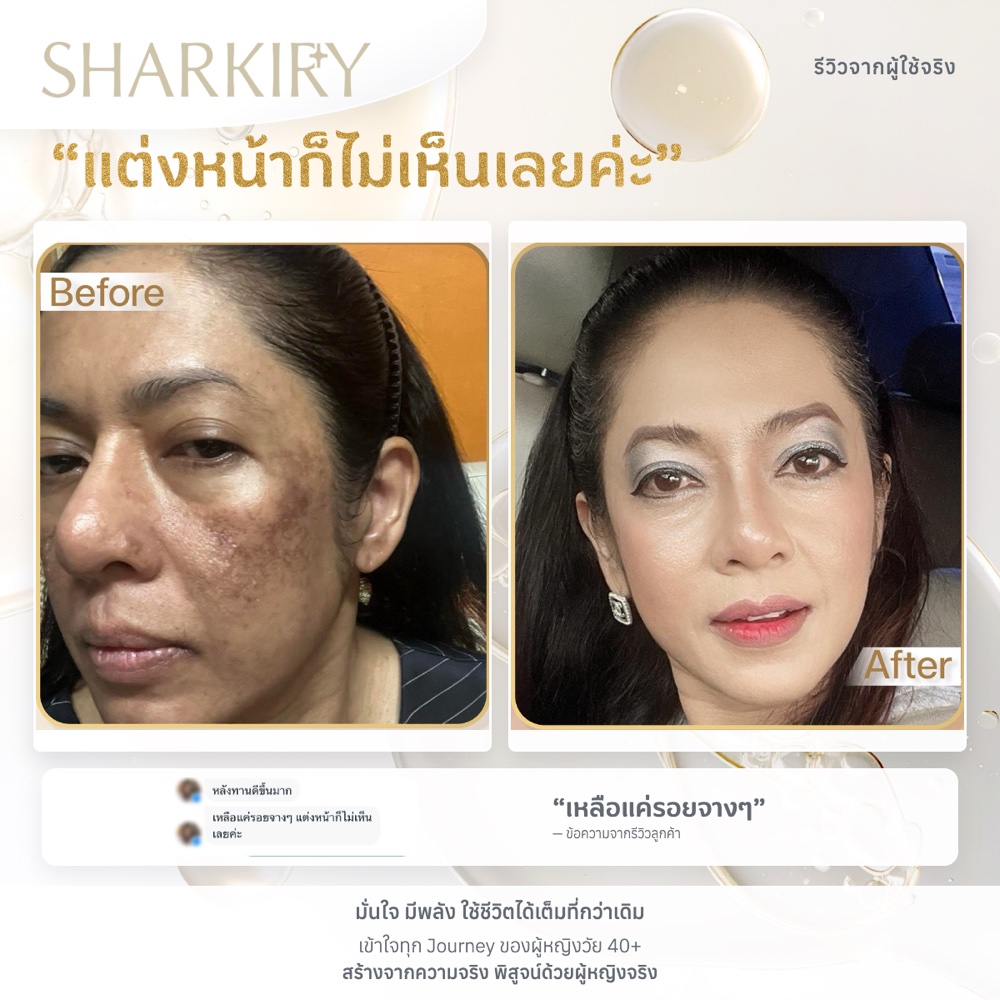 ภาพรีวิวบางส่วนจากผู้ใช้จริงชาร์กิรี่ ภาพที่ 07
