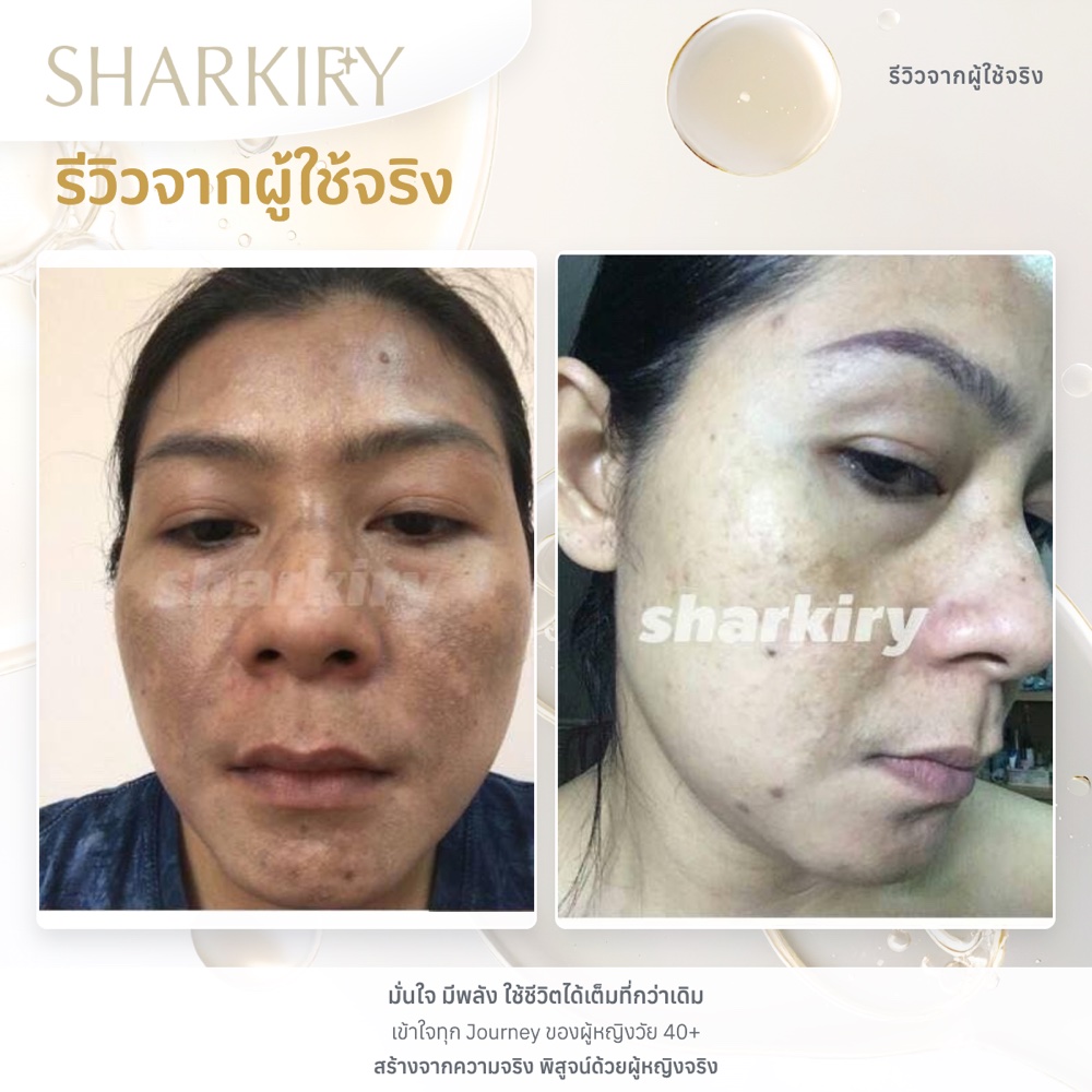 ภาพรีวิวบางส่วนจากผู้ใช้จริงชาร์กิรี่ ภาพที่ 08