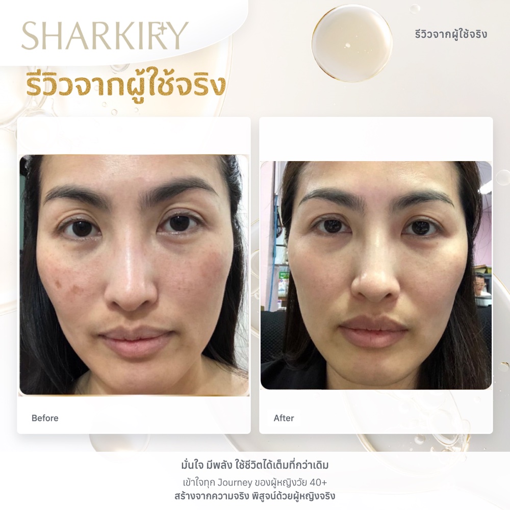 ภาพรีวิวบางส่วนจากผู้ใช้จริงชาร์กิรี่ ภาพที่ 09
