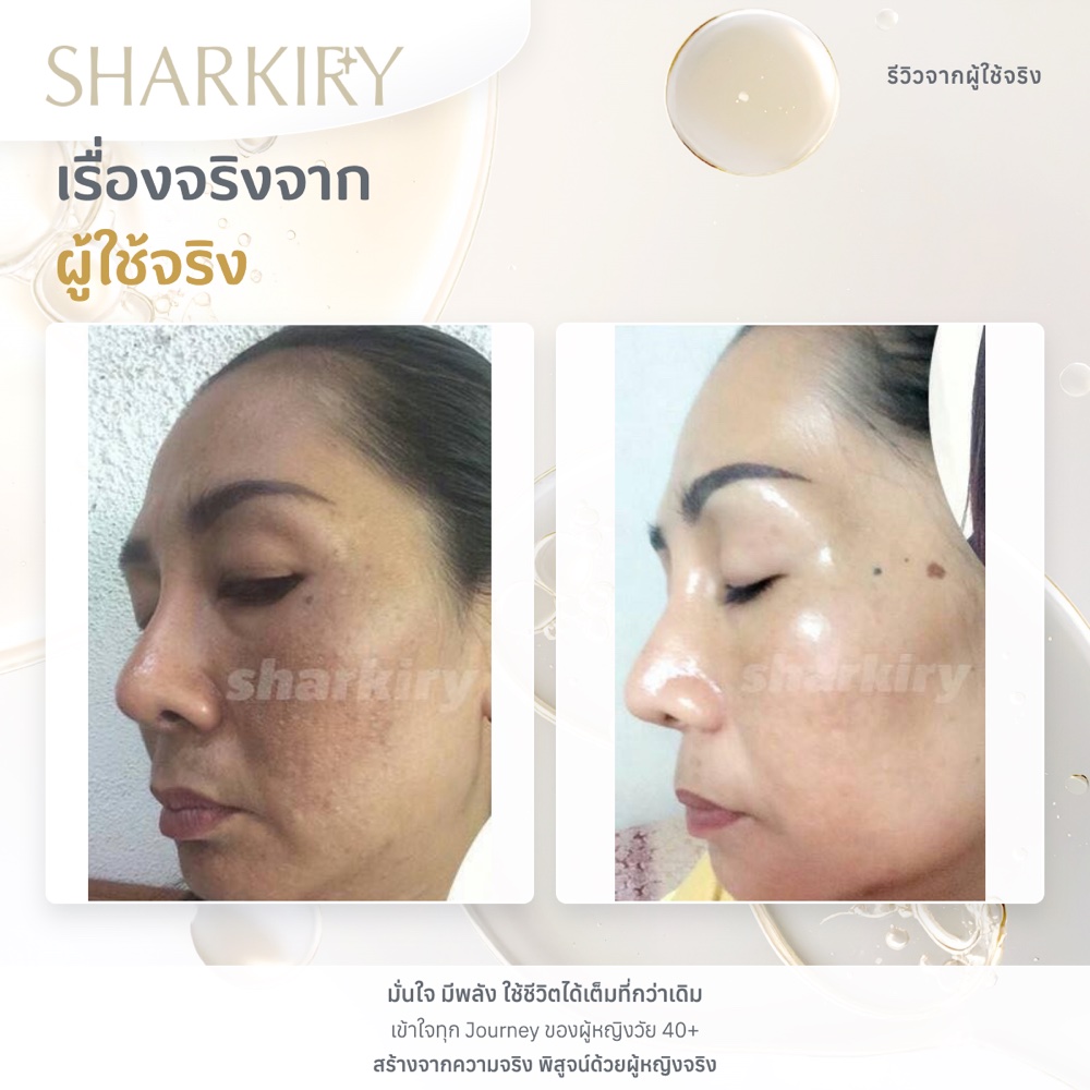 ภาพรีวิวบางส่วนจากผู้ใช้จริงชาร์กิรี่ ภาพที่ 10