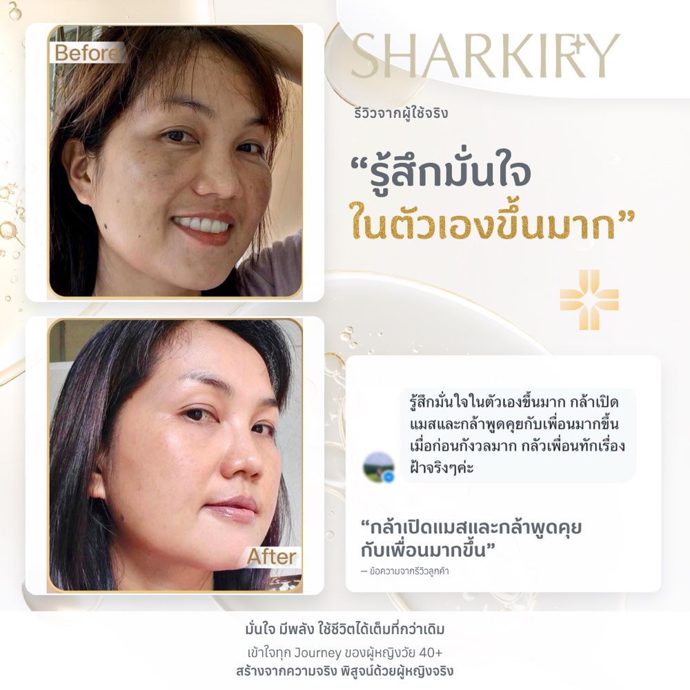 ภาพรีวิวบางส่วนจากผู้ใช้จริงชาร์กิรี่ ภาพที่ 11