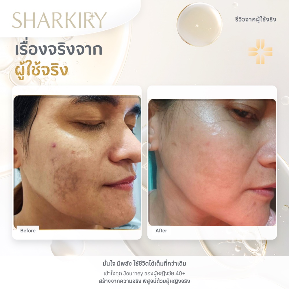 ภาพรีวิวบางส่วนจากผู้ใช้จริงชาร์กิรี่ ภาพที่ 12