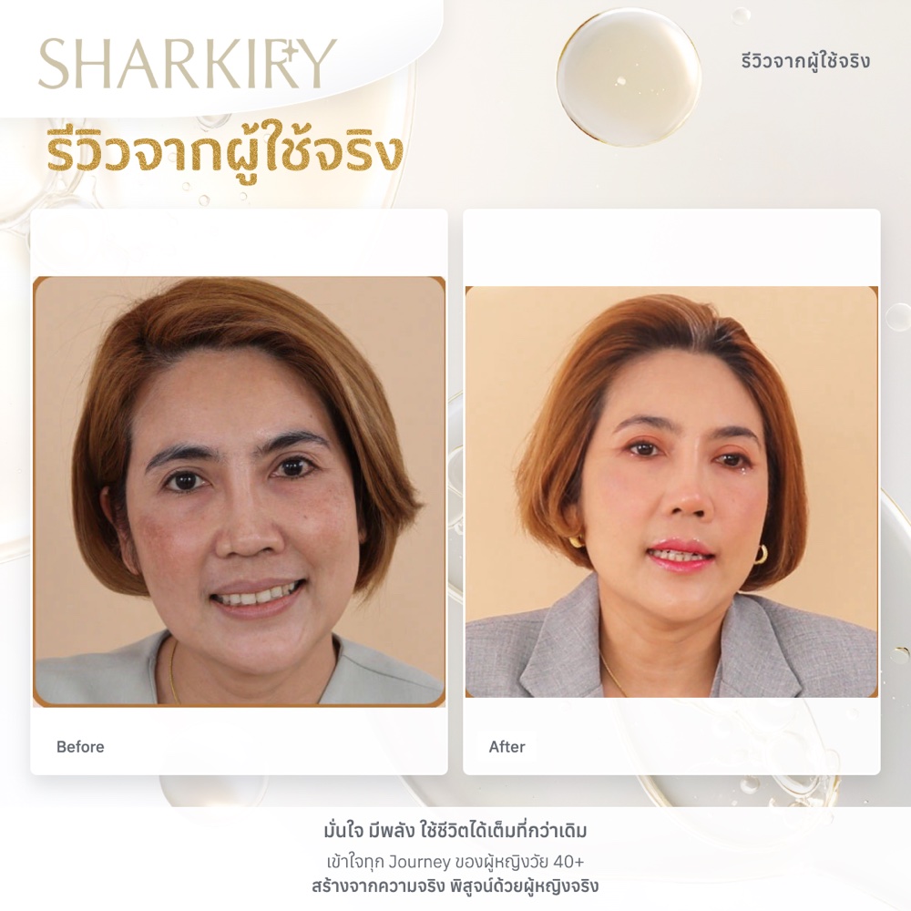 ภาพรีวิวบางส่วนจากผู้ใช้จริงชาร์กิรี่ ภาพที่ 13