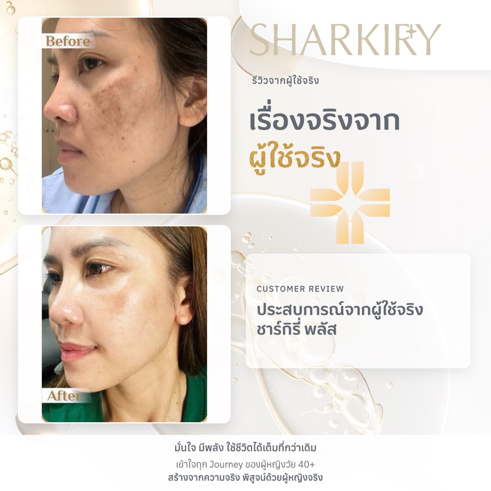 ภาพรีวิวบางส่วนจากผู้ใช้จริงชาร์กิรี่ ภาพที่ 14