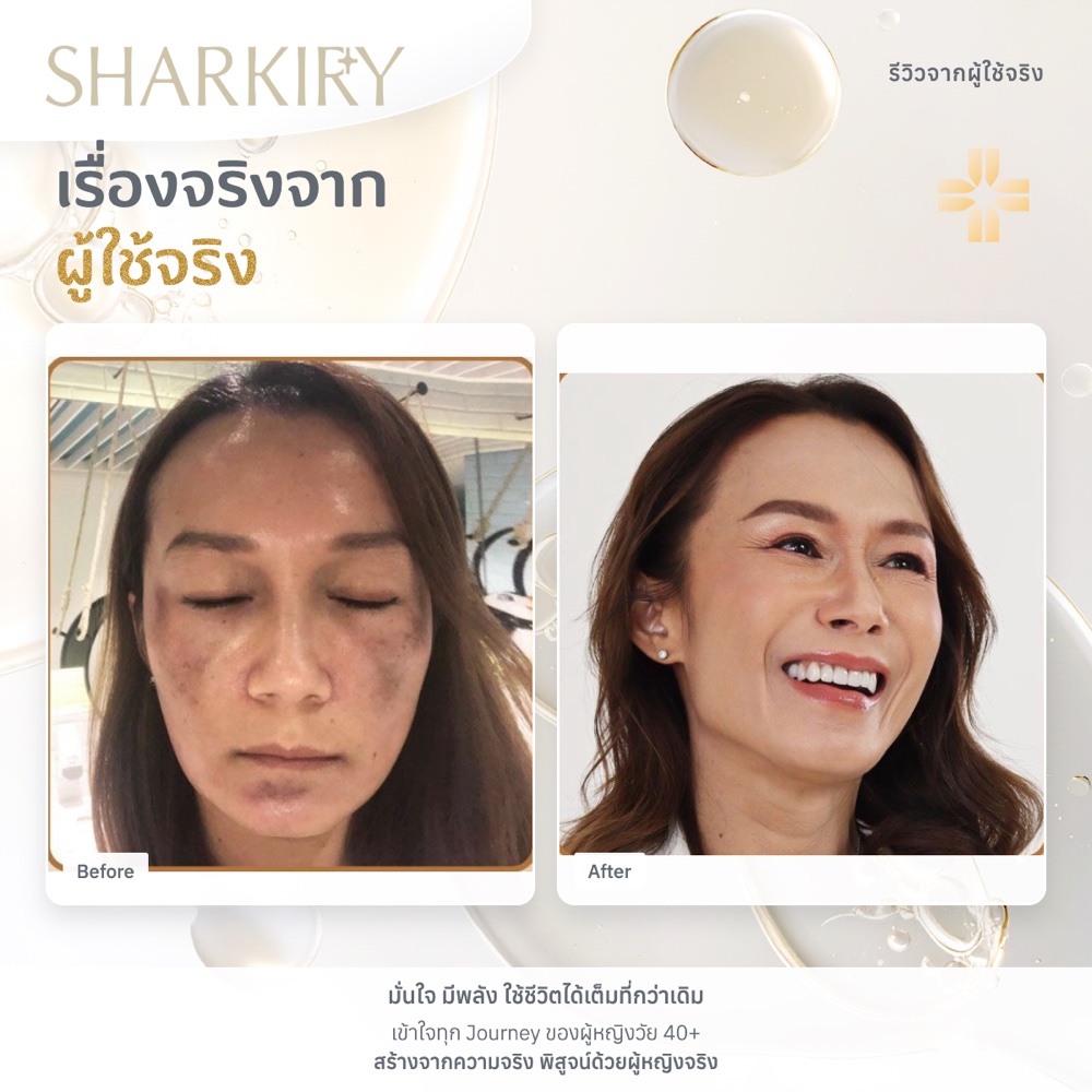 ภาพรีวิวบางส่วนจากผู้ใช้จริงชาร์กิรี่ ภาพที่ 15