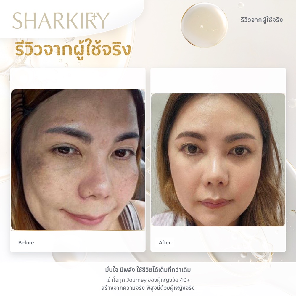 ภาพรีวิวบางส่วนจากผู้ใช้จริงชาร์กิรี่ ภาพที่ 16