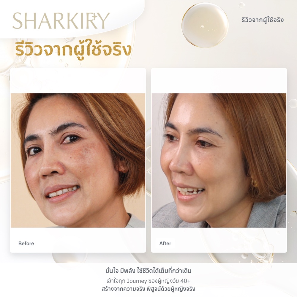 ภาพรีวิวบางส่วนจากผู้ใช้จริงชาร์กิรี่ ภาพที่ 17