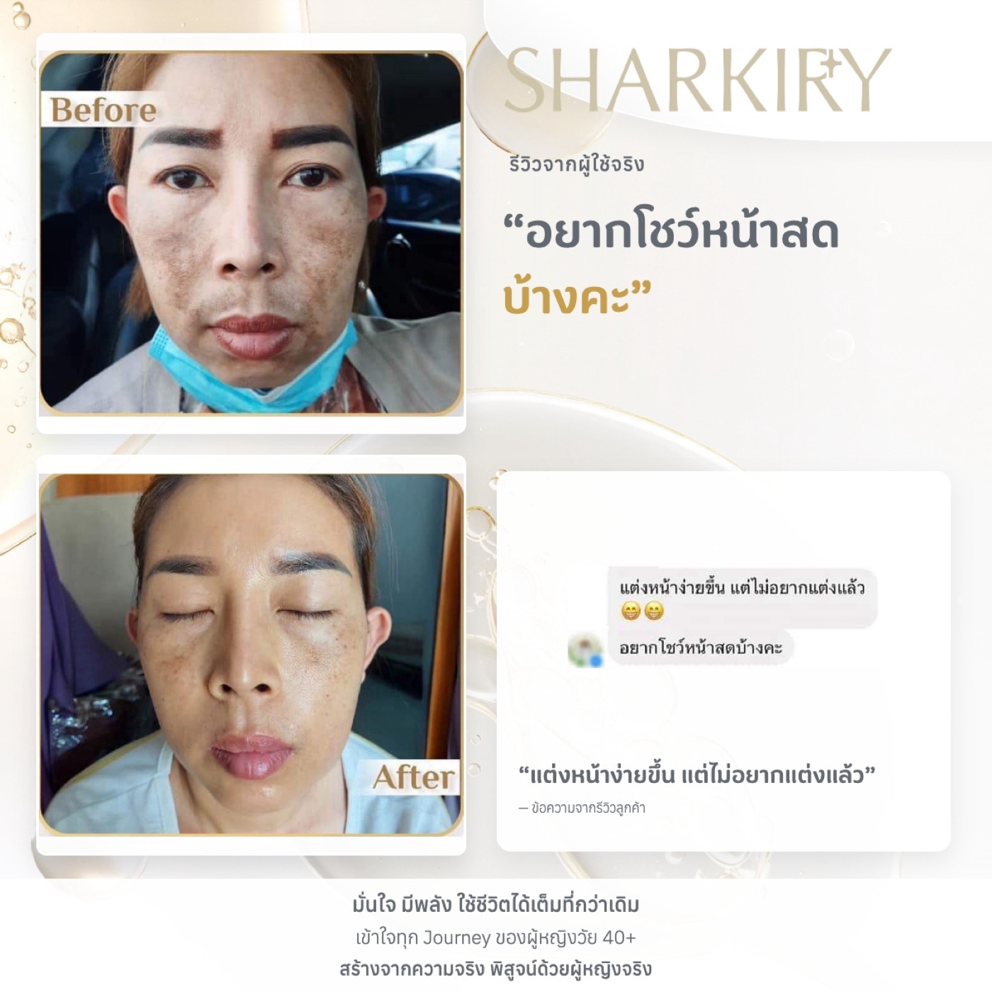ภาพและข้อความรีวิวบางส่วนจากผู้ใช้จริงชาร์กิรี่