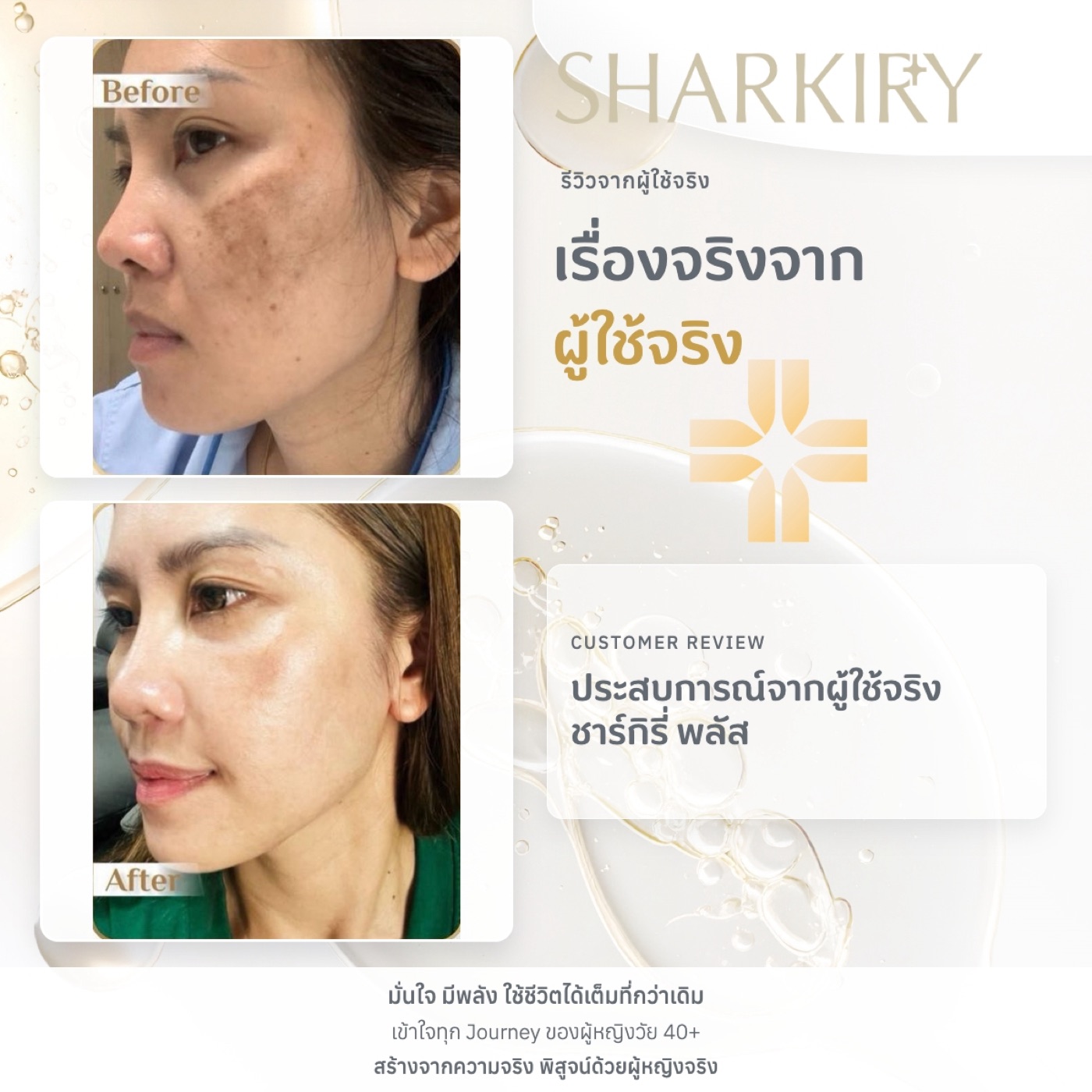 ภาพรีวิวจากผู้ใช้จริงชาร์กิรี่ พลัส